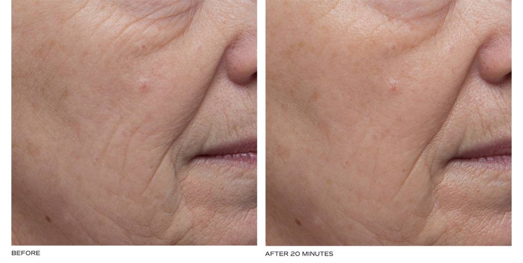 elemis before and after